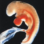 Embrione quarta settimana