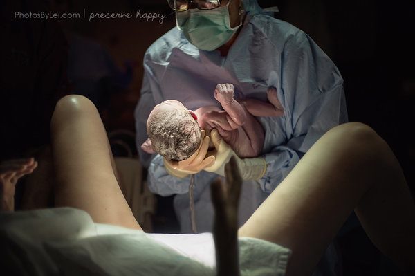 Il parto in ospedale - Foto di Leilani Rogers