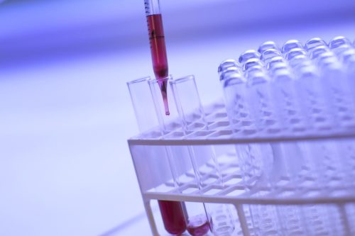 Toxo Test