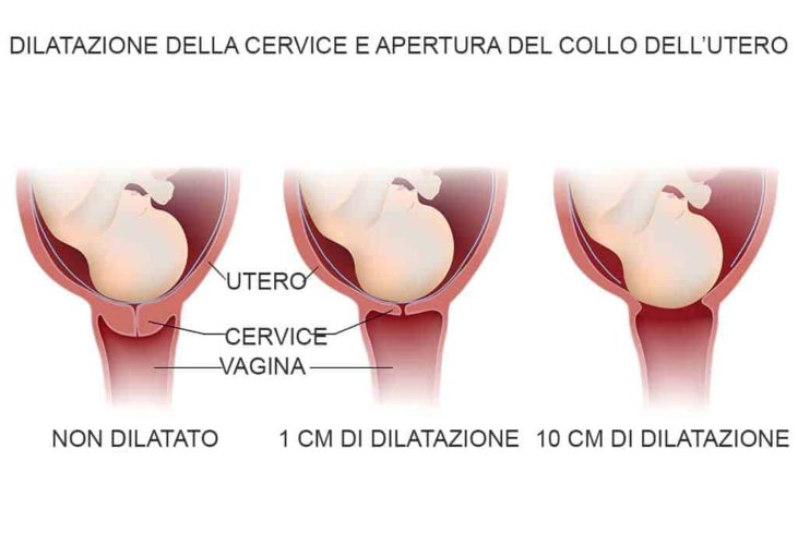 Il travaglio: riconoscere i suoi segnali e sapere come si evolve. Il travaglio: riconoscere i suoi segnali e sapere come si evolve.