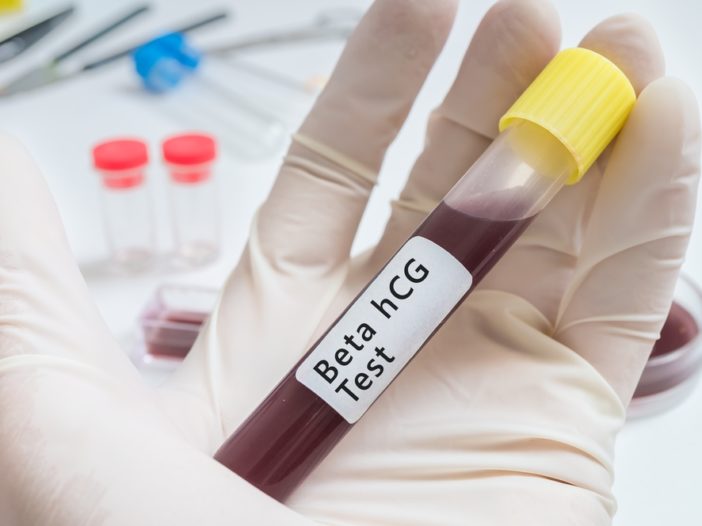 Beta Hcg