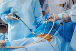 Intervento chirurgico laparoscopia