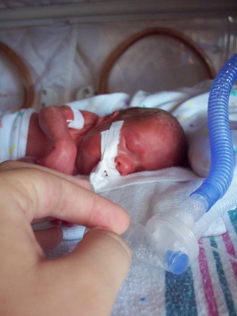 Brescia: Mosca (SIN), la prematurità é una malattia grave